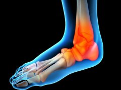 The function of ankle brace